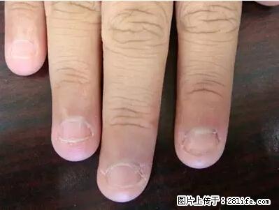 剪指甲、挖耳屎，这些日常小动作竟隐藏大危害！ - 绵阳生活资讯 - 绵阳28生活网 mianyang.28life.net